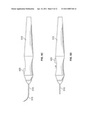 OCULAR IMPLANT WITH STIFFNESS QUALITIES, METHODS OF IMPLANTATION AND SYSTEM diagram and image