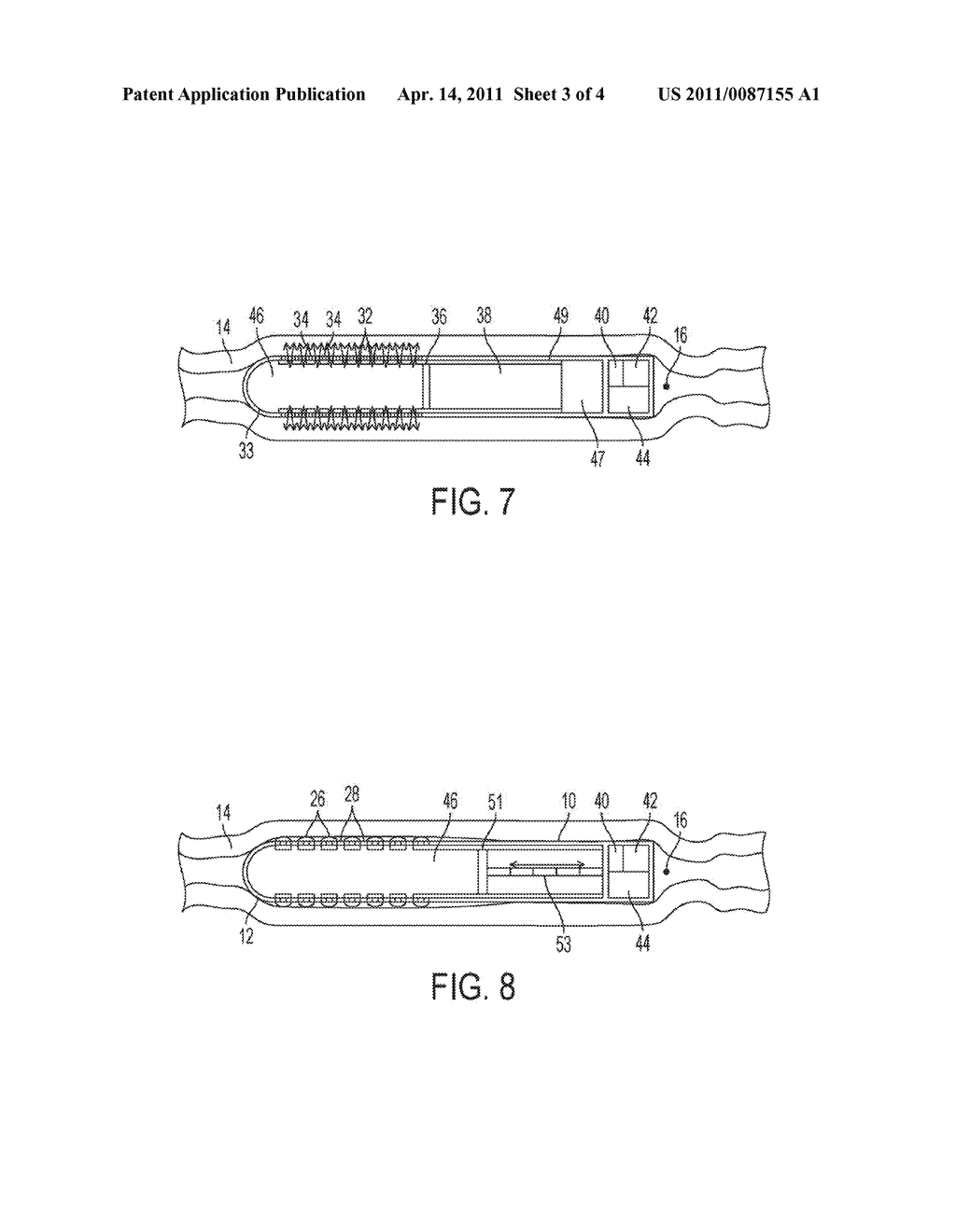TRANSMUCOSAL DRUG DELIVERY DEVICE AND METHOD INCLUDING ELECTRICALLY-ACTUATED PERMEATION ENHANCEMENT - diagram, schematic, and image 04