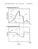 APPLICATION OF A SYSTEM PARAMETER AS A METHOD AND MECHANISM FOR CONTROLLING EYE CHAMBER STABILITY diagram and image