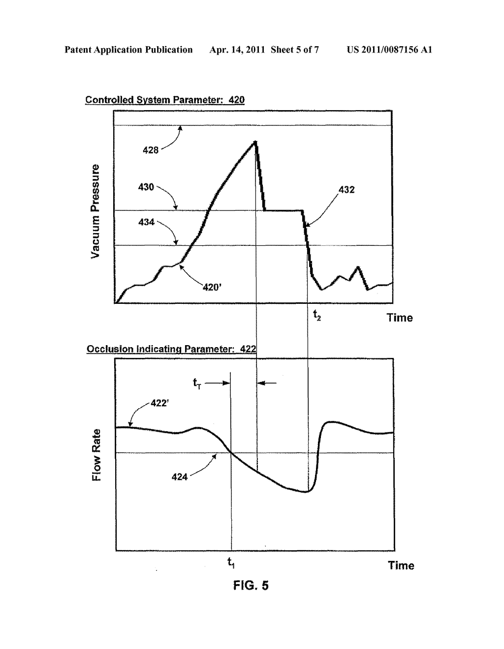 APPLICATION OF A SYSTEM PARAMETER AS A METHOD AND MECHANISM FOR CONTROLLING EYE CHAMBER STABILITY - diagram, schematic, and image 06