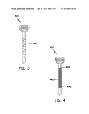 TROCAR WITH RETENTION CANNULA diagram and image