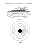 WOUND CLEANSING APPARATUS IN-SITU diagram and image