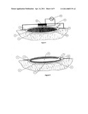 WOUND CLEANSING APPARATUS IN-SITU diagram and image