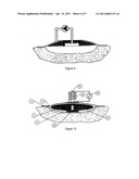 WOUND CLEANSING APPARATUS IN-SITU diagram and image