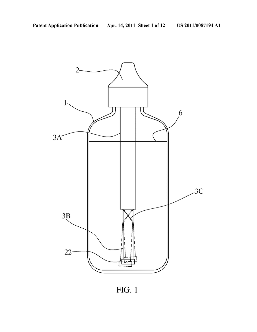 High Flow Volume Nasal Irrigation Device and Method for Alternating Pulsatile and Continuous Fluid Flow - diagram, schematic, and image 02