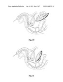 MULTIFUNCTION CARBASUS FOR LAPAROSCOPIC OPERATION diagram and image