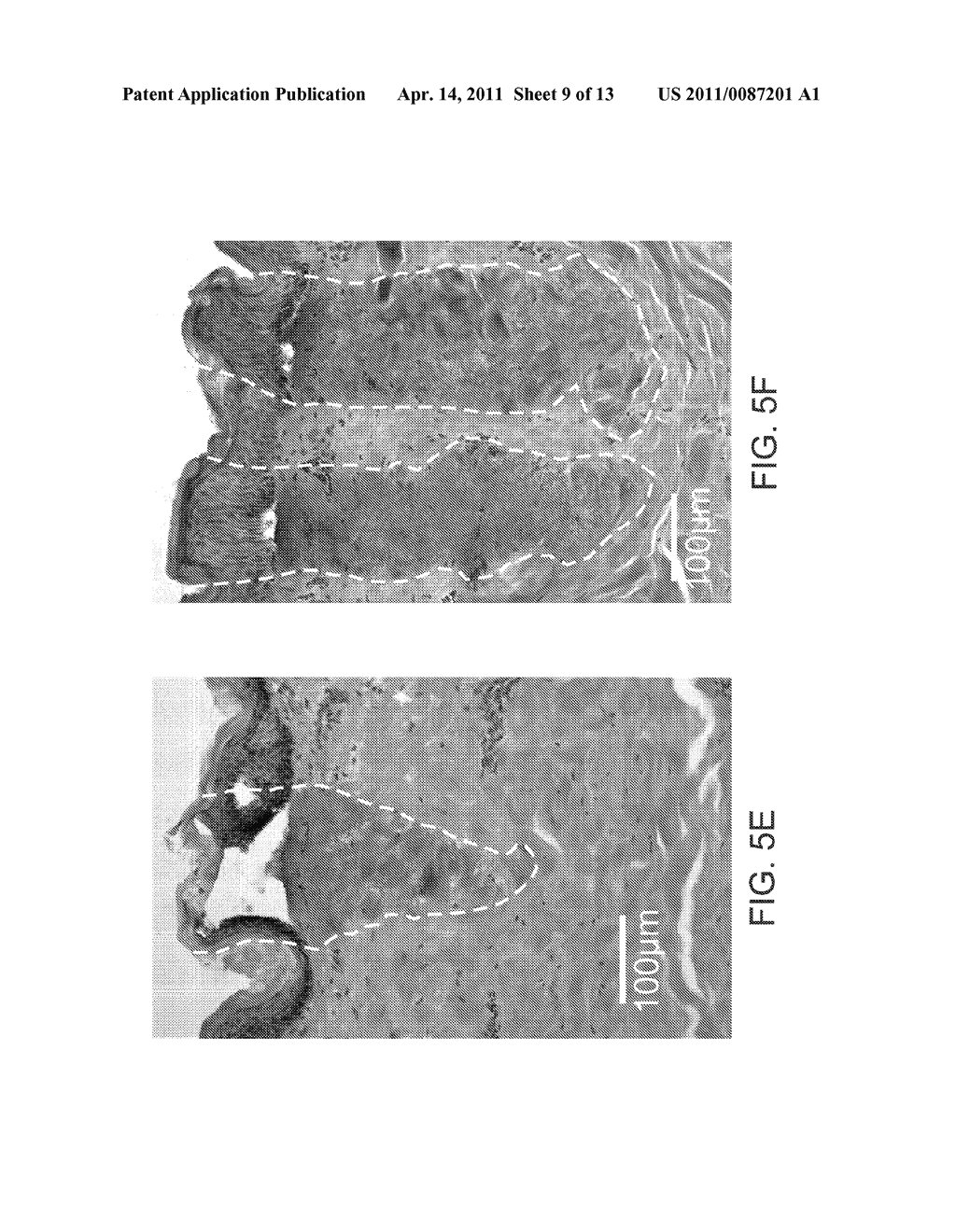 APPARATUS AND METHOD FOR ADJUSTABLE FRACTIONAL OPTICAL DERMATOLOGICAL TREATMENT - diagram, schematic, and image 10