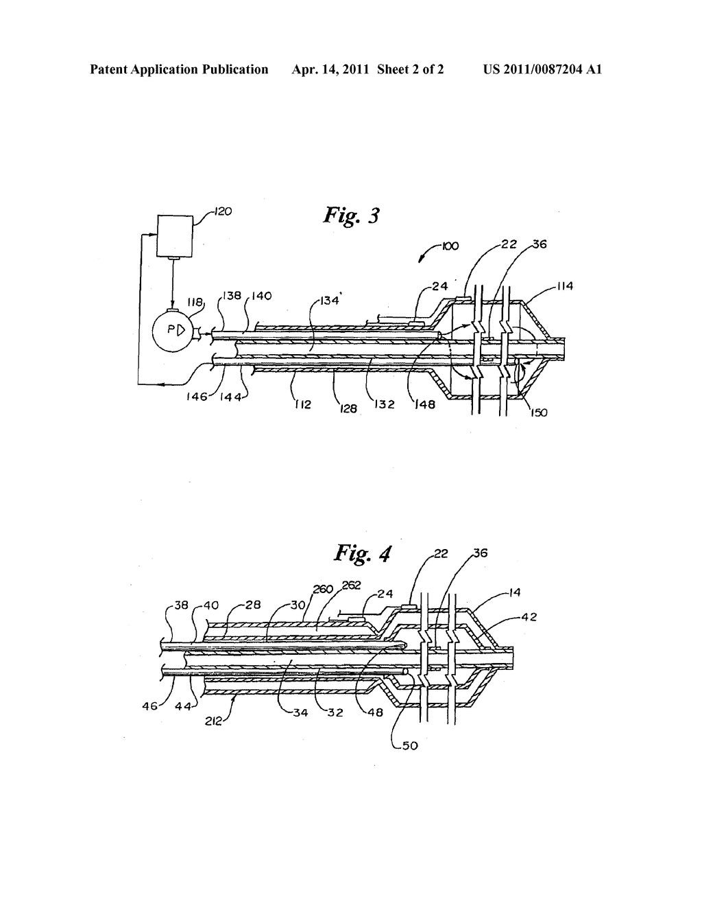 CRYOPLASTY DEVICE AND METHOD - diagram, schematic, and image 03