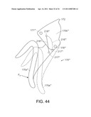 SURGICAL INSTRUMENT FOR TRANSMITTING ENERGY TO TISSUE COMPRISING A MOVABLE ELECTRODE OR INSULATOR diagram and image