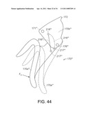 SURGICAL INSTRUMENT FOR TRANSMITTING ENERGY TO TISSUE COMPRISING STEAM CONTROL PATHS diagram and image