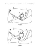 SURGICAL GENERATOR FOR ULTRASONIC AND ELECTROSURGICAL DEVICES diagram and image