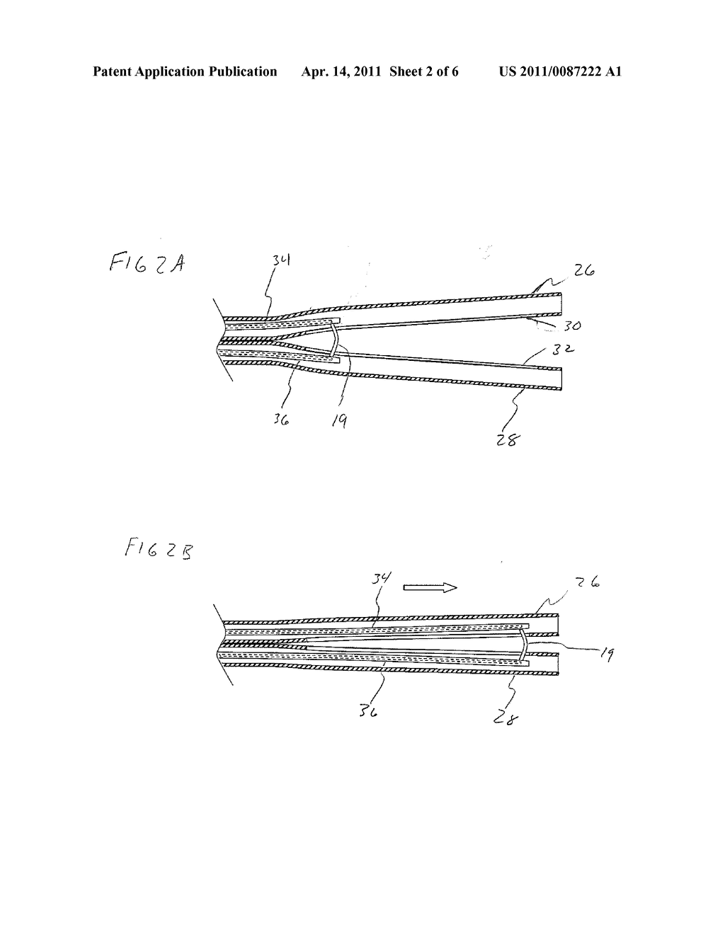 Tissue Resection Device - diagram, schematic, and image 03