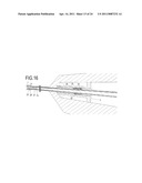 SEALING HOLES IN BONY CRANIAL ANATOMY USING CUSTOM FABRICATED INSERTS diagram and image