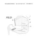 SEALING HOLES IN BONY CRANIAL ANATOMY USING CUSTOM FABRICATED INSERTS diagram and image