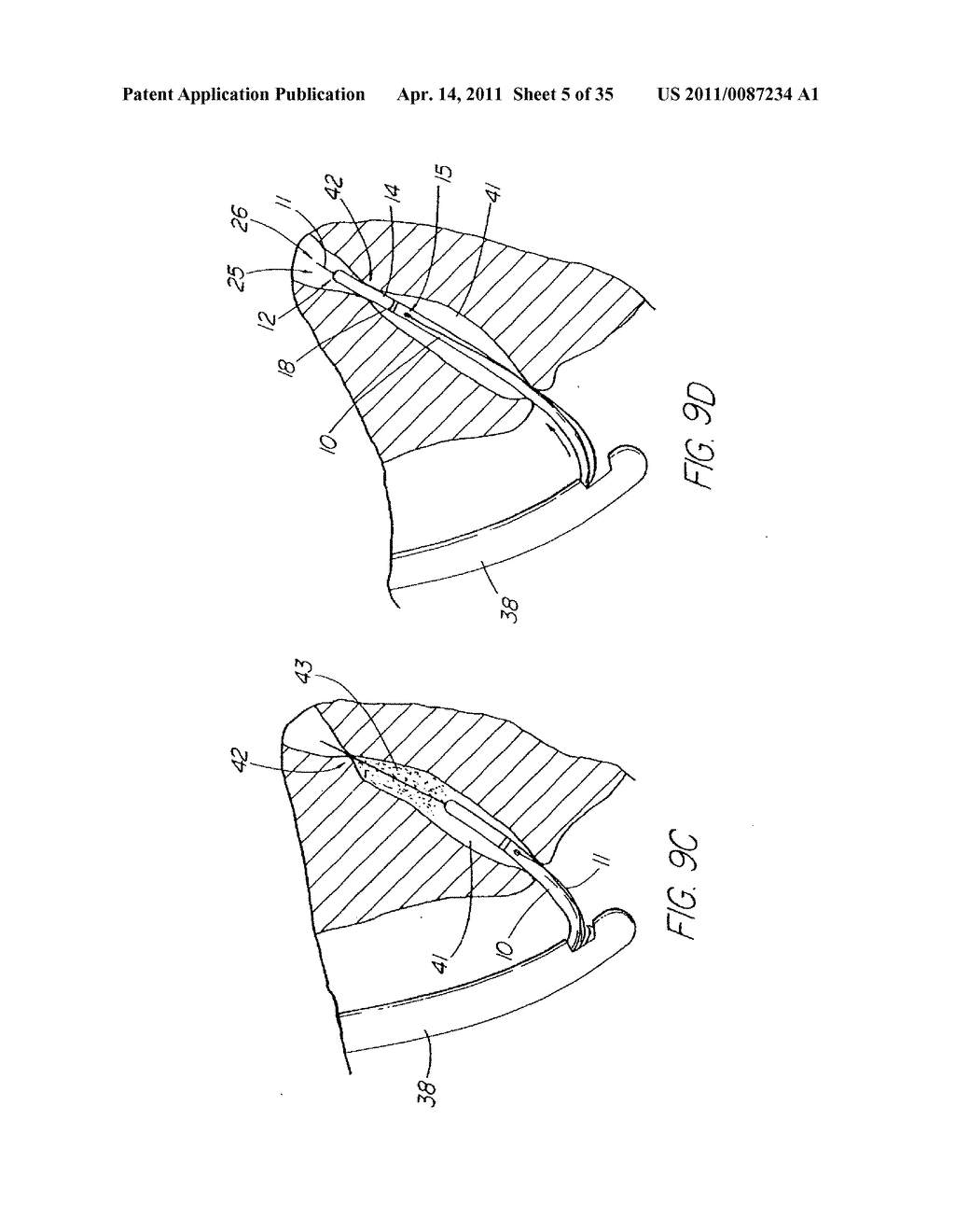 SYSTEM AND METHOD FOR INTRODUCING MULTIPLE MEDICAL DEVICES - diagram, schematic, and image 06