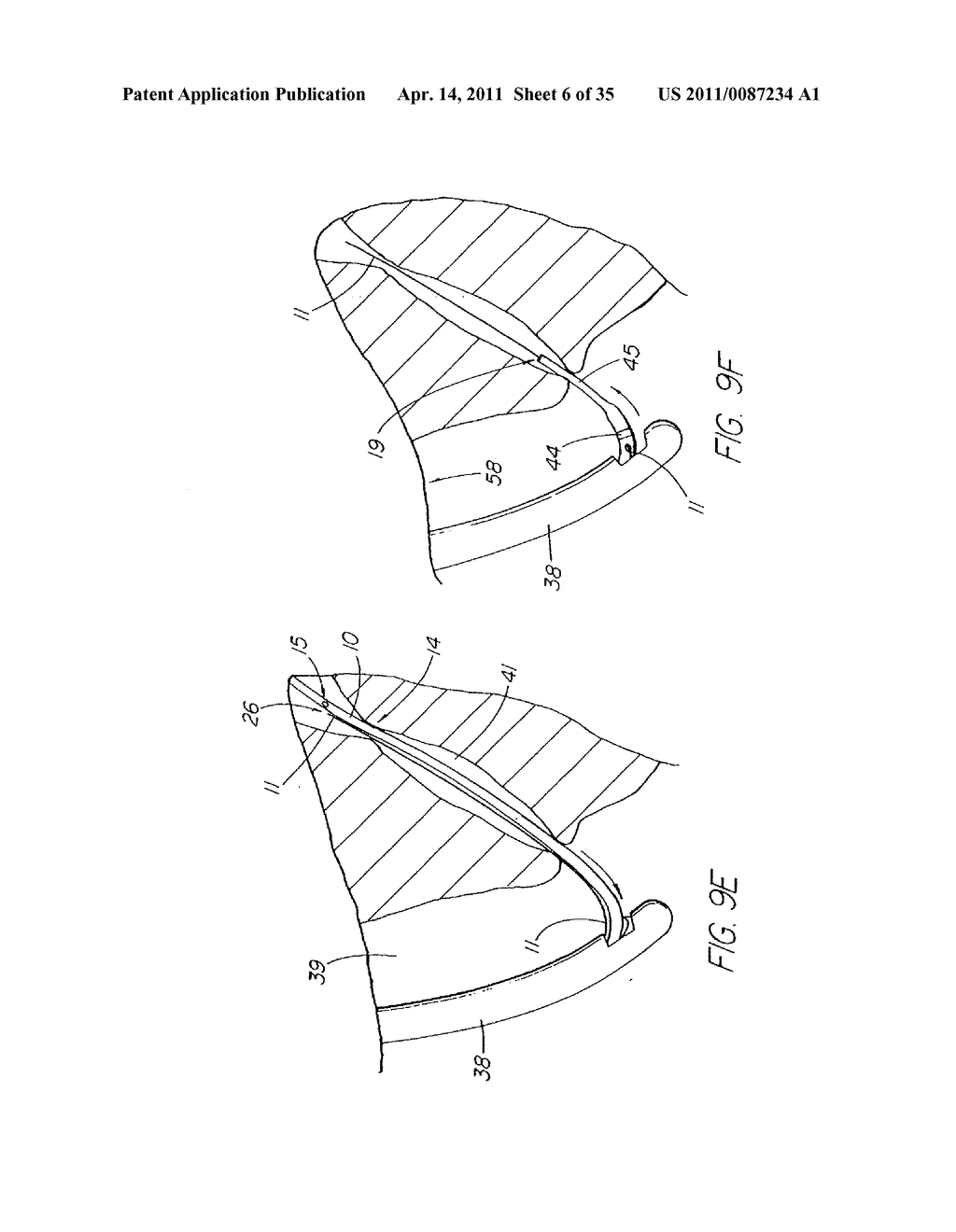 SYSTEM AND METHOD FOR INTRODUCING MULTIPLE MEDICAL DEVICES - diagram, schematic, and image 07