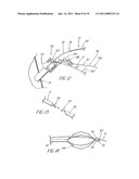 SYSTEM AND METHOD FOR INTRODUCING MULTIPLE MEDICAL DEVICES diagram and image