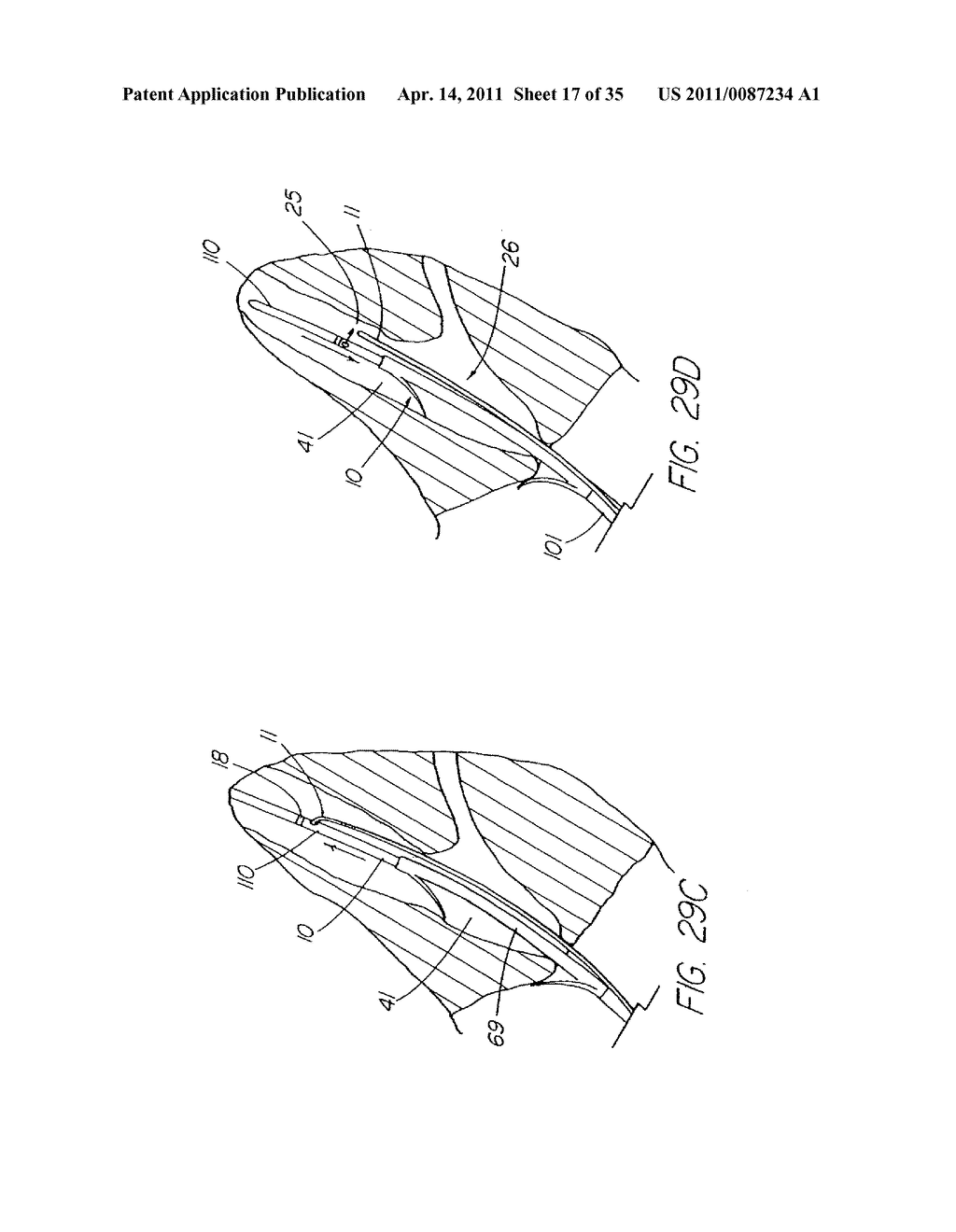 SYSTEM AND METHOD FOR INTRODUCING MULTIPLE MEDICAL DEVICES - diagram, schematic, and image 18