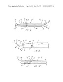 SYSTEM AND METHOD FOR INTRODUCING MULTIPLE MEDICAL DEVICES diagram and image