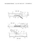 SYSTEM AND METHOD FOR INTRODUCING MULTIPLE MEDICAL DEVICES diagram and image