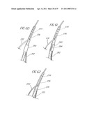 SYSTEM AND METHOD FOR INTRODUCING MULTIPLE MEDICAL DEVICES diagram and image