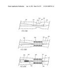 SYSTEM AND METHOD FOR INTRODUCING MULTIPLE MEDICAL DEVICES diagram and image