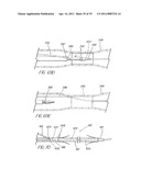 SYSTEM AND METHOD FOR INTRODUCING MULTIPLE MEDICAL DEVICES diagram and image