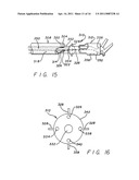 METHOD AND APPARATUS FOR PERFORMING MINIMALLY INVASIVE CARDIAC PROCEDURES diagram and image