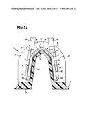 Surgical clip cartridge and housing member for use therein diagram and image