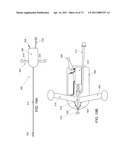 MINIMALLY INVASIVE DISCECTOMY diagram and image