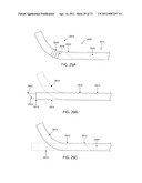 MINIMALLY INVASIVE DISCECTOMY diagram and image