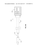 MINIMALLY INVASIVE DISCECTOMY diagram and image