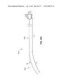 MINIMALLY INVASIVE DISCECTOMY diagram and image