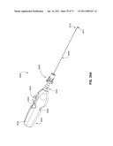 MINIMALLY INVASIVE DISCECTOMY diagram and image