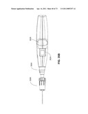 MINIMALLY INVASIVE DISCECTOMY diagram and image