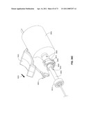 MINIMALLY INVASIVE DISCECTOMY diagram and image