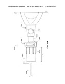 MINIMALLY INVASIVE DISCECTOMY diagram and image