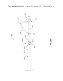 MINIMALLY INVASIVE DISCECTOMY diagram and image