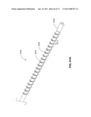 MINIMALLY INVASIVE DISCECTOMY diagram and image