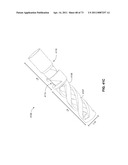 MINIMALLY INVASIVE DISCECTOMY diagram and image