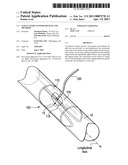 Vasculature Closure Devices and Methods diagram and image