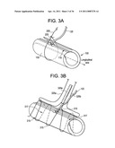 Vasculature Closure Devices and Methods diagram and image