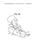 Vasculature Closure Devices and Methods diagram and image