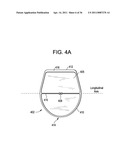 Vasculature Closure Devices and Methods diagram and image