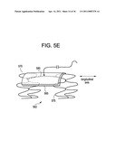 Vasculature Closure Devices and Methods diagram and image