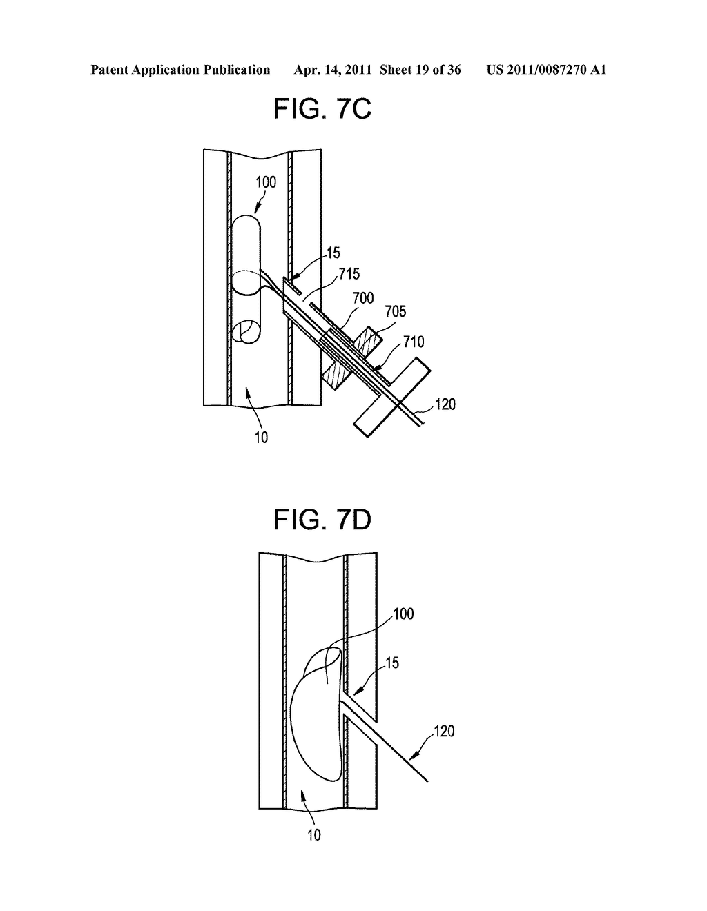 Vasculature Closure Devices and Methods - diagram, schematic, and image 20