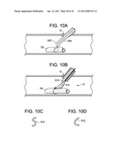 Vasculature Closure Devices and Methods diagram and image