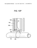 Vasculature Closure Devices and Methods diagram and image