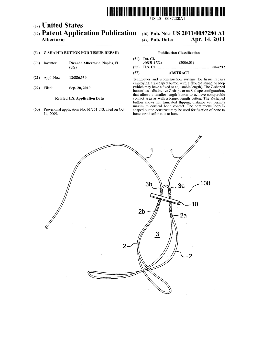 Z-SHAPED BUTTON FOR TISSUE REPAIR - diagram, schematic, and image 01