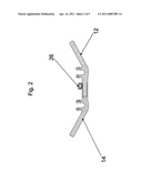 Trans-Iliac Connector diagram and image